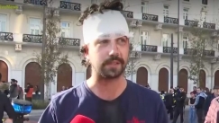 Ο φοιτητής που τραυματίστηκε στο Σύνταγμα είπε στον «αέρα» του Mega: «Μην το "κόψετε", τραυματίστηκα με γκλοπ αστυνομίας» (vid)