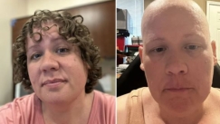 Διαγνώστηκε με καρκίνο και την έβαλαν να κάνει χημειοθεραπείες: Τελικά αποδείχθηκε ότι είχαν κάνει λάθος (vid)
