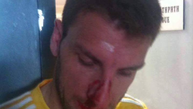 Χτύπησαν ποδοσφαιριστές του Ιάλυσου! (pics)