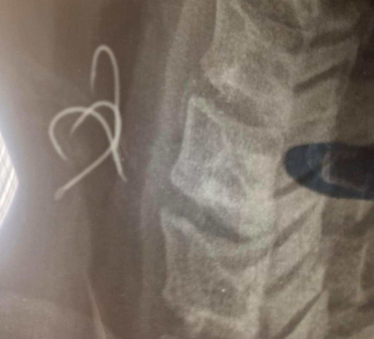 Η ακτινογραφία του 38χρονου