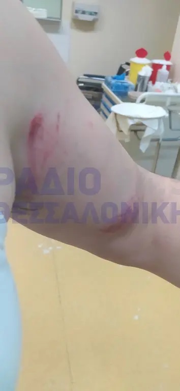 θύμα ξυλοδαρμού σε λεωφορείο του ΟΑΣΘ