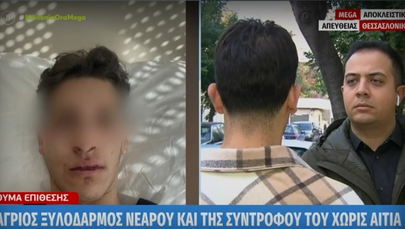 Δέκα άτομα ξυλοκόπησαν 20χρονο και την φίλη του στην Θεσσαλονίκη: Φέρονται να είναι αθλητές πυγμαχίας (vid)