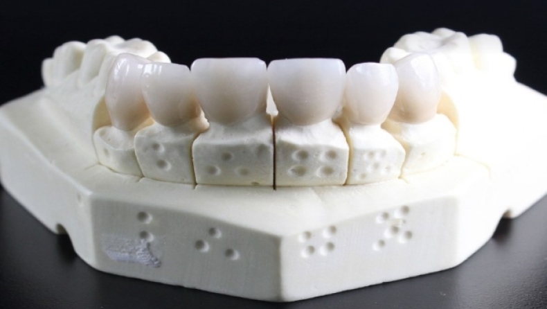 Οι επιστήμονες αποκάλυψαν τον λόγο που οι άνθρωποι έχουν στραβά δόντια και γιατί αυτό δεν συνέβαινε πάντα